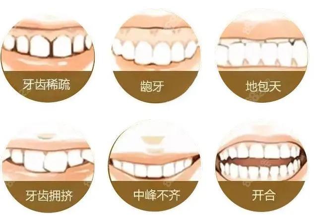 牙齒矯正八